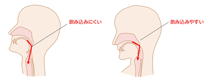 顎を引いていない姿勢（左）と顎を引いた姿勢（右）